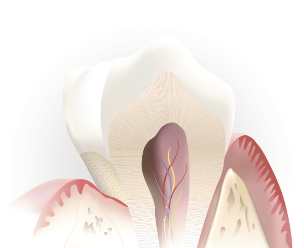 Animated tooth before root canal therapy