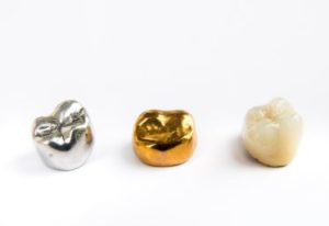 Separate silver, gold and white dental crowns